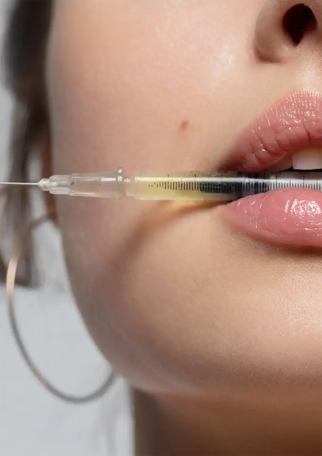 Séance de mésothérapie par micro-injections en cabinet chez Be Life Medical Clinic à Bruxelles