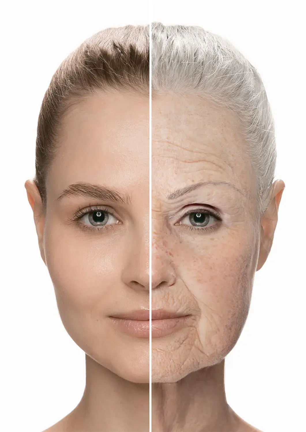 Amélioration de la qualité de la peau grâce aux soins esthétiques chez Be Life Medical Clinic à Bruxelles