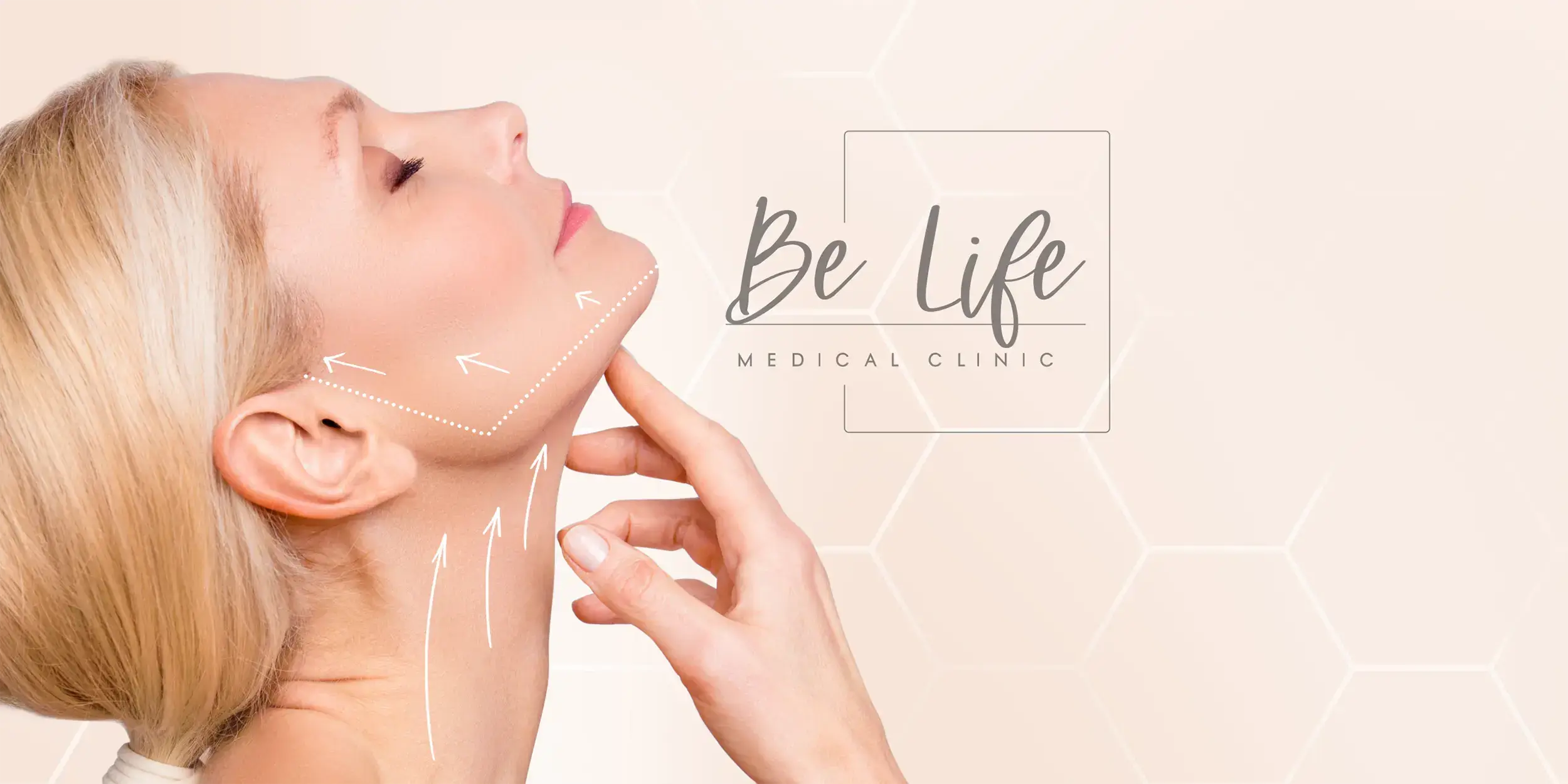 Pose de fils tenseurs pour effet liftant sans chirurgie en cabinet chez Be Life Medical Clinic à Bruxelles